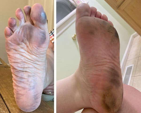 How to Clean Black Stained Feet