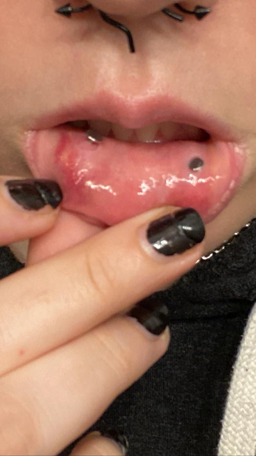 How to Clean Snake Bites Piercing